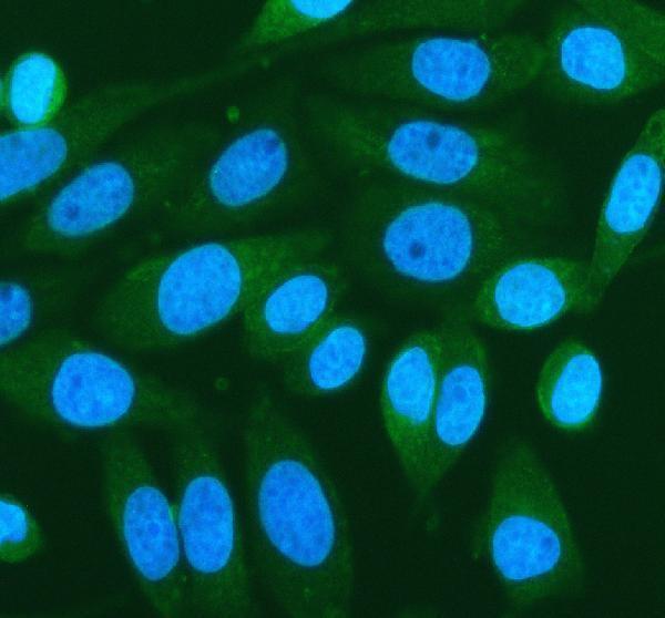 PRKD2 Antibody SiHa Cell IF. Immunofluorescent staining of SiHa cells with PRKD2 antibody (green) at 5 ug/ml. Enzymatic antigen retrieval was performed for 15 minutes prior to staining. Nuclei are counterstained with DAPI (blue). PRKD2 immunoreactivity is observed predominantly within the cytoplasm, consistent with the expected localization of this serine threonine kinase that regulates intracellular signaling, vesicle trafficking, cell survival, and proliferation.
