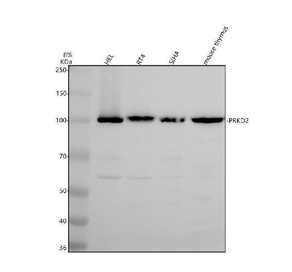 PRKD2 Antibody Human and Mouse WB. Western blot testing of 1) human HEL, 2) human RT4, 3) human SiHa, and 4) mouse thymus lysates with PRKD2 antibody at 0.5 ug/ml. A prominent immunoreactive band is detected at approximately 105 kDa in all samples, consistent with the expected migration of PRKD2 despite its predicted molecular weight of approximately 97 kDa. The results demonstrate specific detection of this serine threonine kinase, which functions in intracellular signaling pathways regulating cell proliferation, survival, vesicle trafficking, and stress responses.