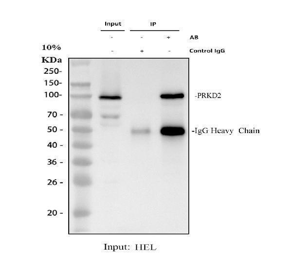 PRKD2 Antibody Human HEL IP-WB. Immunoprecipitation of PRKD2 from human HEL whole cell lysate followed by western blot analysis using PRKD2 antibody. Lane 1: Input HEL whole cell lysate (30 ug). Lane 2: Immunoprecipitation using rabbit control IgG (negative control). Lane 3: Immunoprecipitation with 2 ug PRKD2 antibody from 500 ug HEL whole cell lysate. A specific immunoreactive band is detected at approximately 105 kDa, consistent with the expected migration of PRKD2 despite its predicted molecular weight of approximately 97 kDa. The enrichment of PRKD2 in the immunoprecipitated sample, with no corresponding band in the IgG control, demonstrates the suitability of this serine threonine kinase antibody for immunoprecipitation and western blot applications.