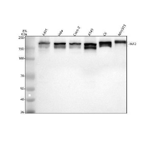 Inverted Formin 2 Antibody Human, Rat and Mouse WB. Western blot testing of human A431, HeLa, Caco-2 and A549 cell lysates, rat C6 cell lysate and mouse NIH/3T3 cell lysate with Inverted Formin 2 Antibody at 0.5 ug/ml. Lane 1: human A431; Lane 2: human HeLa; Lane 3: human Caco-2; Lane 4: human A549; Lane 5: rat C6; Lane 6: mouse NIH/3T3. Predicted molecular weight: ~136 kDa; the INF2 protein is routinely observed at approximately 170-180 kDa due to isoform variation, protein structure and migration characteristics during SDS-PAGE. Inverted Formin 2 Antibody / Formin Protein Antibody detects endogenous INF2 expression and supports studies of actin cytoskeleton remodeling, intracellular organization and formin protein regulation pathways.