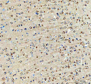Inverted Formin 2 Antibody Rat Brain IHC. Immunohistochemistry staining of FFPE rat brain tissue with Inverted Formin 2 Antibody at 2 ug/ml. HIER was performed using pH 8 EDTA buffer, followed by blocking with 10% goat serum. The tissue section was incubated with rabbit anti-INF2 antibody overnight at 4Â°C, followed by HRP-conjugated goat anti-rabbit IgG secondary antibody and DAB chromogen detection. Inverted Formin 2 Antibody / Formin Protein Antibody demonstrates cytoplasmic staining consistent with INF2 expression and supports studies of actin cytoskeleton remodeling, neuronal cell biology and formin-mediated cellular regulation pathways.