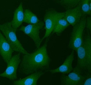 Inverted Formin 2 Antibody A549 Cell IF. Immunofluorescent staining of human A549 cells with Inverted Formin 2 Antibody at 5 ug/ml. Enzyme antigen retrieval was performed for 15 minutes, followed by blocking with 10% goat serum. Cells were incubated with rabbit anti-INF2 antibody overnight at 4Â°C, followed by DyLight 488 conjugated goat anti-rabbit IgG secondary antibody (green). Nuclei were counterstained with DAPI (blue). Inverted Formin 2 Antibody / Formin Protein Antibody demonstrates cytoplasmic staining consistent with INF2 expression and supports studies of actin cytoskeleton remodeling, intracellular organization and formin-mediated cellular regulation pathways.