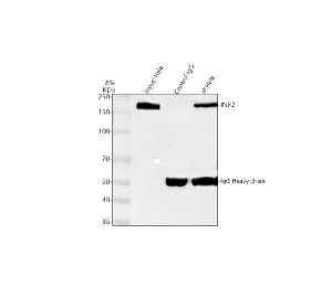 Inverted Formin 2 Antibody Human Cell IP. Immunoprecipitation of INF2 protein from 500 ug of human HeLa whole cell lysate using 2 ug of Inverted Formin 2 Antibody. Immunoprecipitated protein was analyzed by Western blot, with input lysate and rabbit IgG control samples included for comparison. INF2 was detected at approximately 180 kDa, above the predicted 136 kDa molecular weight due to isoform variation, protein structure and SDS-PAGE migration characteristics. Inverted Formin 2 Antibody / Formin Protein Antibody successfully enriches endogenous INF2 protein and supports studies of actin cytoskeleton remodeling, protein interactions and formin-mediated cellular regulation pathways.