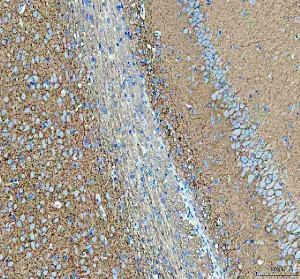 ATP1A3 Antibody Rat Brain IHC. Immunohistochemistry staining of FFPE rat brain tissue with ATP1A3 Antibody at 2 ug/ml. HIER was performed using pH 8 EDTA buffer, followed by blocking with 10% goat serum. The tissue section was incubated with rabbit anti-ATP1A3 antibody overnight at 4Â°C, followed by HRP-conjugated goat anti-rabbit IgG secondary antibody and DAB chromogen detection. ATP1A3 Antibody / Sodium Potassium ATPase Antibody demonstrates neuronal staining consistent with ATPase alpha 3 expression and supports studies of sodium potassium ion transport, membrane excitability and nervous system regulation pathways.