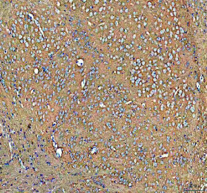 ATP1A3 Antibody Mouse Brain IHC. Immunohistochemistry staining of FFPE mouse brain tissue with ATP1A3 Antibody at 2 ug/ml. HIER was performed using pH 8 EDTA buffer, followed by blocking with 10% goat serum. The tissue section was incubated with rabbit anti-ATP1A3 antibody overnight at 4Â°C, followed by HRP-conjugated goat anti-rabbit IgG secondary antibody and DAB chromogen detection. ATP1A3 Antibody / Sodium Potassium ATPase Antibody demonstrates neuronal staining consistent with ATPase alpha 3 expression and supports studies of ion transport, membrane potential regulation and nervous system signaling pathways.