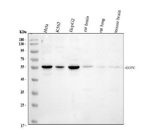 PIST Antibody / Golgi Trafficking Protein Antibody Human Cancer Cell WB. Western blot analysis of human HeLa, K562 and HepG2 cell lysates, rat brain and lung tissue lysates, and mouse brain tissue lysate using PIST Antibody / Golgi Trafficking Protein Antibody. Samples were tested with the primary antibody at 0.5 ug/ml. A specific band was detected at approximately 51 kDa, consistent with the predicted molecular weight of PIST/GOPC. These results support the use of PIST Antibody / Golgi Trafficking Protein Antibody for studying Golgi trafficking protein expression and intracellular protein sorting pathways across human, rat and mouse samples.