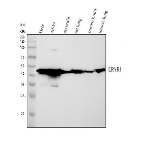 LPAR1 Antibody Human, Rat and Mouse WB. Western blot analysis of LPAR1 Antibody using lysates from 1) human HeLa cells, 2) human A549 cells, 3) rat brain tissue, 4) rat lung tissue, 5) mouse brain tissue, and 6) mouse lung tissue. Samples (30 ug/lane) were separated on a 10% SDS-PAGE gel under reducing conditions, transferred to a nitrocellulose membrane, and detected with LPAR1 Antibody at 0.25 ug/mL followed by an HRP-conjugated secondary antibody and ECL detection. A specific band is observed at approximately 41 kDa in all samples, consistent with the predicted molecular weight of LPAR1/EDG2. These results demonstrate that LPAR1 Antibody, an EDG2 Antibody, specifically detects endogenous receptor expression across human, rat, and mouse samples.