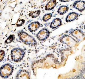 KLF5 Antibody Rat Small Intestine High-Magnification IHC. Immunohistochemical analysis of FFPE rat small intestine tissue using KLF5 Antibody. Heat-induced epitope retrieval was performed in pH 8.0 EDTA buffer prior to incubation with the primary antibody at 2 ug/mL overnight at 4Â°C. An HRP-conjugated goat anti-rabbit secondary antibody with DAB chromogen was used for visualization. At higher magnification, strong nuclear staining is evident within the crypt epithelial cells, with comparatively weaker labeling of the differentiated villus epithelium, consistent with the established role of KLF5 in epithelial proliferation and intestinal homeostasis. These results demonstrate that KLF5 Antibody, an Epithelial Transcription Factor Antibody, specifically detects endogenous KLF5 in FFPE rat intestinal tissue.