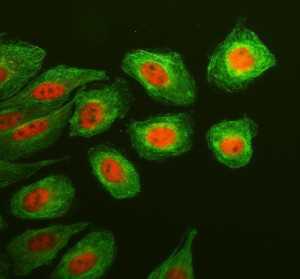 KLF5 Antibody SiHa Cell IF. Immunofluorescent staining of SiHa cells using KLF5 Antibody together with alpha tubulin antibody. Cells underwent enzyme-mediated antigen retrieval for 15 minutes before incubation with KLF5 Antibody at 5 ug/mL and an alpha tubulin antibody overnight at 4Â°C. A Cy3-conjugated goat anti-rabbit secondary antibody was used to detect KLF5 (red), while a Fluoro488-conjugated goat anti-mouse secondary antibody labeled alpha tubulin (green). Prominent nuclear localization of KLF5 is observed within the cytoskeletal framework defined by alpha tubulin, consistent with the expected distribution of this epithelial transcription factor. These results demonstrate that KLF5 Antibody, an Epithelial Transcription Factor Antibody, specifically detects endogenous KLF5 in cultured human cells.