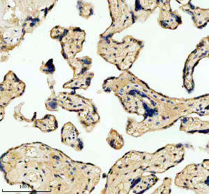 LARS2 Antibody Human Placenta IHC. Immunohistochemical analysis of FFPE human placenta tissue using LARS2 Antibody. Heat-induced epitope retrieval was performed in pH 8.0 EDTA buffer prior to incubation with the primary antibody at 2 ug/mL overnight at 4Â°C. An HRP-conjugated goat anti-rabbit secondary antibody with DAB chromogen was used for visualization. Moderate granular cytoplasmic staining is observed throughout the trophoblast cells, consistent with the expected mitochondrial localization of leucyl-tRNA synthetase 2. These results demonstrate that LARS2 Antibody, a Mitochondrial Leucyl-tRNA Synthetase Antibody, specifically detects endogenous LARS2 in FFPE human placental tissue.