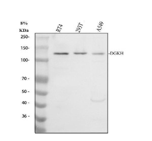 DGKH Antibody Human Cancer Cell WB. Western blot analysis of DGKH Antibody using lysates from 1) human RT4 cells, 2) human 293T cells, and 3) human A549 cells. Samples (30 ug/lane) were separated on an 8% SDS-PAGE gel under reducing conditions, transferred to a nitrocellulose membrane, and detected with DGKH Antibody at 0.5 ug/mL followed by an HRP-conjugated secondary antibody and ECL detection. A specific band is observed at approximately 135 kDa in all three cell lines, consistent with the predicted molecular weight of DGKH. These results demonstrate that DGKH Antibody, a Diacylglycerol Kinase Eta Antibody, specifically detects endogenous DGKH across multiple human cancer cell lines.