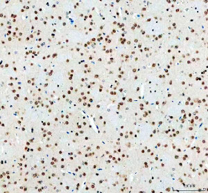 ELAVL1 Antibody Rat Brain IHC. Immunohistochemical analysis of FFPE rat brain tissue using ELAVL1 Antibody. Heat-induced epitope retrieval was performed in pH 8.0 EDTA buffer prior to incubation with the primary antibody (1:100) overnight at 4Â°C. An HRP-conjugated goat anti-rabbit secondary antibody with DAB chromogen was used for visualization. Strong nuclear staining is observed throughout neuronal cell populations with minimal cytoplasmic immunoreactivity, consistent with the characteristic nuclear localization of ELAVL1 and its role in regulating messenger RNA stability. These results demonstrate that ELAVL1 Antibody, an ELAV Like RNA Binding Protein 1 Antibody, specifically detects endogenous ELAVL1 in FFPE rat brain tissue.