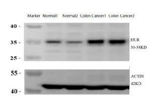 ELAVL1 Antibody Rat Colon Cancer Model WB. Western blot analysis of ELAVL1 Antibody using lysates from 1) normal rat colon tissue, 2) normal rat colon tissue, 3) rat colon cancer model tissue, and 4) rat colon cancer model tissue. Samples (30 ug/lane) were separated on an 8% SDS-PAGE gel under reducing conditions, transferred to a membrane, and detected with ELAVL1 Antibody at a 1:2000 dilution followed by an HRP-conjugated secondary antibody and ECL detection. A specific band is observed at approximately 36â38 kDa, with stronger ELAVL1 expression in the rat colon cancer model samples than in normal colon tissue. Actin served as the loading control. These results demonstrate that ELAVL1 Antibody, an ELAV Like RNA Binding Protein 1 Antibody, specifically detects endogenous ELAVL1 and can distinguish differential expression associated with colorectal tumorigenesis.