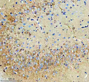 RPS12 Antibody Rat Brain IHC. Immunohistochemical analysis of FFPE rat brain tissue using RPS12 Antibody. Heat-induced epitope retrieval was performed in pH 8.0 EDTA buffer prior to incubation with the primary antibody (1:100) overnight at 4Â°C. An HRP-conjugated goat anti-rabbit secondary antibody with DAB chromogen was used for visualization. Moderate diffuse cytoplasmic staining is observed in neurons, including prominent labeling within the densely packed neuronal layer, consistent with the expected localization of 40S ribosomal protein S12 as a component of the cytosolic ribosome and actively translating protein synthesis machinery. These results demonstrate that RPS12 Antibody, a 40S Ribosomal Protein S12 Antibody, specifically detects endogenous RPS12 in FFPE rat brain tissue.