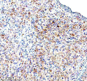 RPS12 Antibody Mouse Ovary IHC. Immunohistochemical analysis of FFPE mouse ovary tissue using RPS12 Antibody. Heat-induced epitope retrieval was performed in pH 8.0 EDTA buffer prior to incubation with the primary antibody (1:100) overnight at 4Â°C. An HRP-conjugated goat anti-rabbit secondary antibody with DAB chromogen was used for visualization. Moderate diffuse cytoplasmic staining is observed throughout the ovarian cells, consistent with the expected cytoplasmic localization of 40S ribosomal protein S12 within actively translating ribosomes. These results demonstrate that RPS12 Antibody, a 40S Ribosomal Protein S12 Antibody, specifically detects endogenous RPS12 in FFPE mouse ovary tissue.