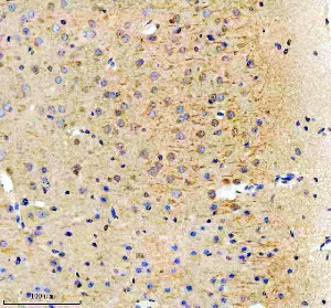 RPS12 Antibody Mouse Brain IHC. Immunohistochemical analysis of FFPE mouse brain tissue using RPS12 Antibody. Heat-induced epitope retrieval was performed in pH 8.0 EDTA buffer prior to incubation with the primary antibody (1:100) overnight at 4Â°C. An HRP-conjugated goat anti-rabbit secondary antibody with DAB chromogen was used for visualization. Diffuse cytoplasmic staining is observed throughout neurons, consistent with the expected localization of 40S ribosomal protein S12 as a constituent of the cytosolic ribosome and actively translating protein synthesis machinery. These results demonstrate that RPS12 Antibody, a 40S Ribosomal Protein S12 Antibody, specifically detects endogenous RPS12 in FFPE mouse brain tissue.