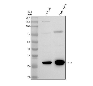 Distal-Less Homeobox 5 Antibody Rat and Mouse Brain WB. Western blot analysis of Distal-Less Homeobox 5 Antibody using lysates from 1) rat brain and 2) mouse brain. Samples (30 ug/lane) were separated on a 10% SDS-PAGE gel under reducing conditions, transferred to a nitrocellulose membrane, and probed with Distal-Less Homeobox 5 Antibody (0.5 ug/mL), followed by an HRP-conjugated secondary antibody and ECL detection. A specific band is detected at approximately 33 kDa in both rat and mouse brain lysates, consistent with the predicted molecular weight of DLX5 (approximately 32 kDa). These results demonstrate that Distal-Less Homeobox 5 Antibody, a DLX-5 Antibody, specifically detects endogenous DLX5 across rodent brain tissues.