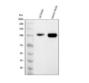 MAG Antibody Rat and Mouse Brain WB. Western blot analysis was performed using MAG Antibody. Lane 1: rat brain tissue lysate; lane 2: mouse brain tissue lysate. A specific immunoreactive band is detected at approximately 100 kDa in both samples, consistent with the heavily glycosylated mature form of Myelin Associated Glycoprotein, which commonly migrates above its predicted molecular weight of approximately 69 kDa. The strong signal in brain tissue reflects the abundant expression of MAG within myelinating oligodendrocytes and myelin-rich regions of the central nervous system. These results demonstrate that this Myelin Associated Glycoprotein Antibody is suitable for Western blot detection of endogenous MAG in rat and mouse brain tissue lysates.