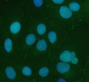 CXADR Antibody Human U-2 OS Cell IF. Immunofluorescent staining of U-2 OS cells using CXADR antibody following enzyme-mediated antigen retrieval (AR0022) for 15 minutes. Cells were incubated with CXADR antibody at 5 ug/ml and detected with a DyLight 488-conjugated secondary antibody (green), with DAPI used as the nuclear counterstain (blue). CXADR immunoreactivity is observed predominantly along the plasma membrane and cell periphery, consistent with the localization of the Coxsackievirus and Adenovirus Receptor at sites of cell-cell adhesion and epithelial junction organization. This result demonstrates that the CXADR Antibody / Coxsackievirus and Adenovirus Receptor Antibody is suitable for immunofluorescent detection and subcellular localization of endogenous CXADR in cultured human cells.
