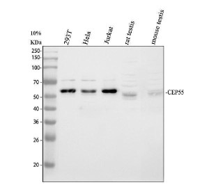 CEP55 Antibody Human Cell, Mouse and Rat Testis WB. Western blot analysis of CEP55 expression in multiple cell and tissue lysates. Lane 1: human HEK293T whole cell lysate. Lane 2: human HeLa whole cell lysate. Lane 3: human Jurkat whole cell lysate. Lane 4: rat testis tissue lysate. Lane 5: mouse testis tissue lysate. Proteins were detected using CEP55 antibody at 0.5 ug/ml. A specific band is observed at approximately 54 kDa in each sample, consistent with the predicted molecular weight of CEP55. This result demonstrates that the CEP55 Antibody / Cytokinesis Protein Antibody is suitable for Western blot detection of endogenous CEP55 in human, rat, and mouse samples.