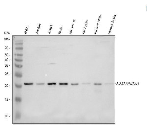 PACAP Antibody Human, Rat and Mouse WB. Western blot analysis of human HEL, Jurkat, K562, and HeLa cell lysates, along with rat testis, rat brain, mouse testis, and mouse brain tissue lysates using PACAP antibody. Lane 1: human HEL; Lane 2: human Jurkat; Lane 3: human K562; Lane 4: human HeLa; Lane 5: rat testis; Lane 6: rat brain; Lane 7: mouse testis; Lane 8: mouse brain. A specific band is detected at approximately 21 kDa across multiple samples. Although the predicted molecular weight of the ADCYAP1 precursor is approximately 19 kDa, migration at approximately 21-25 kDa has been reported and may reflect precursor processing, post-translational modification, or differences in electrophoretic mobility. This result demonstrates that the PACAP antibody is suitable for detecting endogenous neuropeptide precursor expression in both human and rodent cells and tissues.