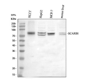 SRBI Antibody Human and Mouse WB. Western blot analysis detected SRBI in human hepatocellular carcinoma tissue (lane 1), human HepG2 cells (lane 2), human MCF-7 cells (lane 3) and mouse liver tissue (lane 4). A prominent immunoreactive band was observed at approximately 85 kDa, which is higher than the predicted molecular weight of about 61 kDa and is consistent with the known glycosylation of this membrane receptor. Additional higher molecular weight bands may represent different glycosylated forms. This SRBI Antibody, an HDL Receptor Antibody, is suitable for detecting SRBI across human and mouse samples in studies of cholesterol transport and lipoprotein biology.