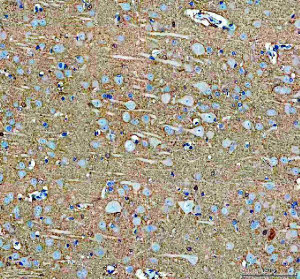 SLC17A7 Antibody Rat Cerebral Cortex IHC. Immunohistochemical staining of FFPE rat brain demonstrated widespread SLC17A7 expression with prominent cytoplasmic and neuropil staining in cortical neurons. Heat-induced epitope retrieval was performed in pH8 EDTA buffer before staining with the primary antibody and HRP-DAB detection. The staining pattern is consistent with the localization of this Glutamate Transporter in excitatory glutamatergic neurons and presynaptic terminals, where it mediates vesicular glutamate loading for synaptic transmission. This SLC17A7 Antibody, a Glutamate Transporter Antibody, is suitable for immunohistochemical studies of cortical glutamatergic signaling, synaptic vesicle biology and neuronal function.