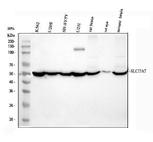 SLC17A7 Antibody Human, Mouse and Rat WB. Western blot analysis detected SLC17A7 in human K562 (lane 1), U2OS (lane 2), SH-SY5Y (lane 3) and U251 (lane 4) cell lysates, as well as rat brain (lane 5), rat eye (lane 6) and mouse brain (lane 7). A predominant immunoreactive band was observed at approximately 53 kDa, slightly lower than the predicted molecular weight of 62 kDa, consistent with previously reported migration of SLC17A7. Strong expression in brain tissues reflects the abundant presence of this glutamate transporter in excitatory neurons. This SLC17A7 Antibody, a Glutamate Transporter Antibody, demonstrates cross-species reactivity and is suitable for studies of glutamatergic neurotransmission, synaptic vesicle biology and neuronal function.