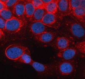 GBP2 Antibody Human A431 IF. Immunofluorescent staining of A431 human epidermoid carcinoma cells using GBP2 Antibody (red) following enzyme-mediated antigen retrieval and DAPI nuclear counterstaining (blue). GBP2 displays predominantly cytoplasmic staining with a punctate distribution, consistent with its localization as an interferon-inducible large GTPase involved in innate immune signaling and host defense. This result demonstrates the utility of GBP2 Antibody, an Interferon Induced GTPase Antibody, for investigating GBP2 localization and interferon-mediated immune responses in cultured human cells.