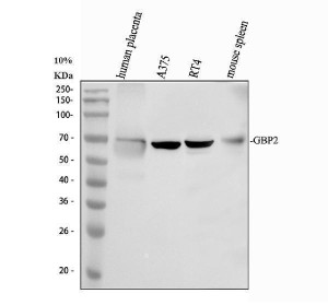 GBP2 Antibody Human and Mouse WB. Western blot analysis of GBP2 Antibody using lysates from lane 1: human placenta tissue, lane 2: human A375 cells, lane 3: human RT4 cells and lane 4: mouse spleen tissue. A specific band is detected at approximately 67-70 kDa in all samples, consistent with the predicted molecular weight of endogenous GBP2. These results demonstrate cross-species detection of GBP2 and support the use of GBP2 Antibody, an Interferon Induced GTPase Antibody, for studies of innate immunity, interferon signaling and host defense mechanisms.