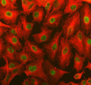 YAF2 Antibody A549 Cell IF. Immunofluorescence analysis of A549 cells demonstrates nuclear localization of YAF2 (green) using YAF2 antibody, while alpha Tubulin (red) serves as a cytoskeletal marker. Cells were treated with AR0022 enzyme antigen retrieval reagent for 15 minutes before incubation with YAF2 antibody (5 ug/ml) and alpha Tubulin antibody, followed by Fluoro488- and Cy3-conjugated secondary antibodies. The merged image shows strong nuclear YAF2 staining distinct from the cytoplasmic microtubule network. This YAF2 Antibody, also called YY1-associated factor 2 Antibody, is suitable for investigating nuclear transcriptional regulation and YY1-associated protein localization.