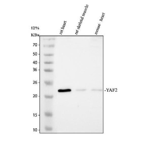 YAF2 Antibody Rat and Mouse Muscle and Heart WB. Western blot analysis demonstrates detection of YAF2 in rat and mouse tissues. Lane 1: rat heart lysate, Lane 2: rat skeletal muscle lysate, Lane 3: mouse heart lysate. A distinct band is detected at approximately 20 kDa, consistent with the expected molecular weight of YAF2. This YAF2 Antibody, also called YY1-associated factor 2 Antibody, is suitable for studies of transcriptional regulation, chromatin-associated signaling, and YY1-mediated gene expression.