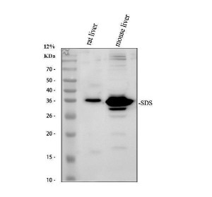 Serine Dehydratase Antibody Rat and Mouse Liver WB. Western blot analysis of rat and mouse liver tissue lysates using Serine Dehydratase Antibody / SDS Antibody. Lane 1: rat liver tissue lysate. Lane 2: mouse liver tissue lysate. Proteins were separated on a 12% SDS-PAGE gel, transferred to a nitrocellulose membrane, and incubated with the primary antibody at 0.5 ug/ml, followed by an HRP-conjugated goat anti-rabbit secondary antibody for chemiluminescent detection. A distinct band was detected at approximately 35 kDa in both liver lysates, consistent with the expected molecular weight of serine dehydratase. This Serine Dehydratase Antibody, also called SDS Antibody, is suitable for studies of amino acid metabolism, gluconeogenesis, liver physiology, and metabolic regulation.