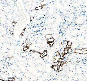 SLC8A1 Antibody Human Kidney IHC. Immunohistochemical analysis of FFPE human kidney tissue using SLC8A1 Antibody / NCX1 Antibody, clone 18S76. Heat-induced epitope retrieval was performed in EDTA buffer (pH 8.0). The tissue was incubated with the recombinant rabbit monoclonal antibody at a 1:50 dilution overnight at 4Â°C, followed by an HRP-conjugated goat anti-rabbit secondary antibody and DAB chromogen detection. Strong membranous staining is observed in renal tubular epithelial cells, consistent with the known localization of SLC8A1 in the kidney, where it regulates sodium-calcium exchange and cellular calcium homeostasis. This SLC8A1 Antibody, also called NCX1 Antibody, is suitable for studies of sodium-calcium exchange, calcium homeostasis, renal physiology, membrane transporter biology, and cardiovascular research.