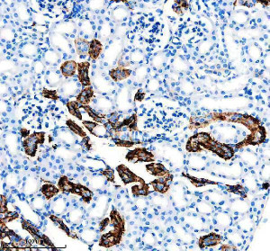 SLC8A1 Antibody Mouse Kidney IHC. Immunohistochemical analysis of FFPE mouse kidney tissue using SLC8A1 Antibody / NCX1 Antibody, clone 18S76. Heat-induced epitope retrieval was performed in EDTA buffer (pH 8.0). The tissue was incubated with the recombinant rabbit monoclonal antibody at a 1:50 dilution overnight at 4Â°C, followed by an HRP-conjugated goat anti-rabbit secondary antibody and DAB chromogen detection. Prominent membranous and cytoplasmic staining is observed in renal tubular epithelial cells, consistent with the known expression of SLC8A1 in kidney tissue and its role in sodium-calcium exchange. This SLC8A1 Antibody, also called NCX1 Antibody, is suitable for studies of sodium-calcium exchange, calcium homeostasis, renal physiology, membrane transporter biology, and cardiovascular research.