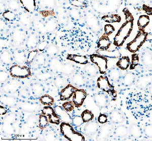 SLC8A1 Antibody Rat Kidney IHC. Immunohistochemical analysis of FFPE rat kidney tissue using SLC8A1 Antibody / NCX1 Antibody, clone 18S76. Heat-induced epitope retrieval was performed in EDTA buffer (pH 8.0). The tissue was incubated with the recombinant rabbit monoclonal antibody at a 1:50 dilution overnight at 4Â°C, followed by an HRP-conjugated goat anti-rabbit secondary antibody and DAB chromogen detection. Strong membranous staining is observed in renal tubular epithelial cells, consistent with the established localization of SLC8A1 in kidney tubules where it contributes to sodium-calcium exchange and calcium homeostasis. This SLC8A1 Antibody, also called NCX1 Antibody, is suitable for studies of sodium-calcium exchange, calcium homeostasis, renal physiology, membrane transporter biology, and cardiovascular research.