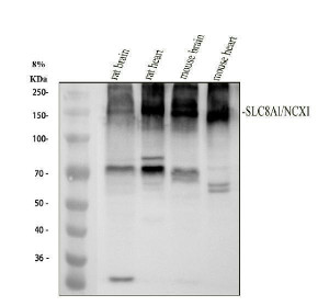 SLC8A1 Antibody Mouse and Rat Brain and Heart WB. Western blot analysis of rat brain (lane 1), rat heart (lane 2), mouse brain (lane 3), and mouse heart (lane 4) tissue lysates using SLC8A1 Antibody / NCX1 Antibody, clone 18S76. Proteins were separated on an 8% SDS-PAGE gel, transferred to a nitrocellulose membrane, and incubated with the recombinant rabbit monoclonal antibody at a 1:500 dilution, followed by an HRP-conjugated goat anti-rabbit secondary antibody for chemiluminescent detection. A prominent band was detected at approximately 140 kDa in all four tissues, consistent with the higher apparent molecular weight commonly observed for glycosylated NCX1 despite a predicted molecular weight of approximately 109 kDa. This SLC8A1 Antibody, also called NCX1 Antibody, is suitable for studies of sodium-calcium exchange, calcium homeostasis, cardiac physiology, membrane transporter biology, and neuronal signaling.