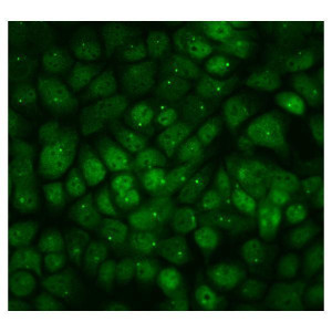 PPM1E Antibody Human A431 Cell IF. Immunofluorescent staining of A431 cells using PPM1E Antibody / Protein Phosphatase 1E Antibody (green). Enzymatic antigen retrieval was performed for 15 minutes before incubation with PPM1E Antibody at 2 ug/ml, followed by a DyLight 488-conjugated goat anti-rabbit secondary antibody. Cells were counterstained with DAPI to visualize nuclei. PPM1E displays predominantly cytoplasmic staining with punctate intracellular labeling, consistent with its role as a PP2C family serine/threonine phosphatase that regulates phosphorylation-dependent signaling pathways. This PPM1E Antibody, also called Protein Phosphatase 1E Antibody, is suitable for studies of protein dephosphorylation, MAPK signaling, neuronal signaling, and cancer-associated signal transduction.