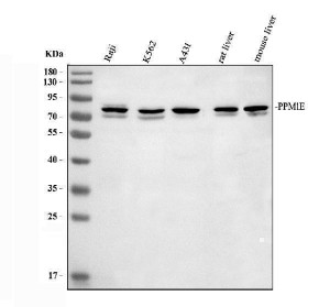 PPM1E Antibody Human and Mouse Liver WB. Western blot analysis of human Raji (lane 1), K562 (lane 2), and A431 (lane 3) whole cell lysates, rat liver (lane 4), and mouse liver (lane 5) tissue lysates using PPM1E Antibody / Protein Phosphatase 1E Antibody at 0.5 ug/ml. A specific band is detected at approximately 84 kDa in all samples, consistent with the predicted molecular weight of PPM1E. This PPM1E Antibody, also called Protein Phosphatase 1E Antibody, is suitable for studies of protein dephosphorylation, MAPK signaling, neuronal signaling, and phosphorylation-dependent signal transduction.