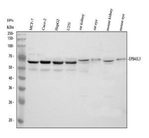 EPB41L5 Antibody Human, Rat and Mouse WB. Western blot testing of human MCF-7 (lane 1), Caco-2 (lane 2), HepG2 (lane 3), U251 (lane 4), rat kidney (lane 5), rat eye (lane 6), mouse kidney (lane 7), and mouse eye (lane 8) lysates using EPB41L5 antibody detected a major band at approximately 58 kDa, consistent with one reported isoform of EPB41L5. Although an additional isoform of approximately 82 kDa has been described, the lower molecular weight form predominated under these experimental conditions. This EPB41L5 Antibody, also called an Epithelial-Mesenchymal Transition Protein Antibody, is useful for investigating epithelial-mesenchymal transition, cell adhesion remodeling, cytoskeletal organization, and cancer metastasis.