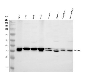 MRPS35 Antibody Human, Rat and Mouse WB. Western blot demonstrates detection of MRPS35 in human OE19, A549, K562, and HepG2 cell lysates, as well as rat heart, rat kidney, mouse heart, and mouse kidney tissue lysates. A distinct immunoreactive band is observed at approximately 37 kDa, consistent with the predicted molecular weight of mitochondrial ribosomal protein S35. The broad detection across multiple human cell lines and rodent tissues indicates conserved expression of this mitochondrial ribosomal protein. This MRPS35 Antibody is suitable for studies of mitochondrial ribosomal protein S35, mitochondrial translation, and mitochondrial function across human, rat, and mouse samples.