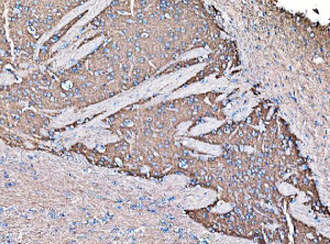 GNAL Antibody Rat Brain IHC. IHC staining of FFPE rat brain tissue using GNAL Antibody (A09404-1). Heat-induced epitope retrieval was performed in EDTA buffer (pH 8.0), followed by blocking with 10% goat serum. The tissue was incubated with the antibody at 2 ug/ml overnight at 4Â°C, followed by biotinylated goat anti-rabbit IgG and SABC/DAB detection. Positive GNAL staining is observed in brain tissue. This GNAL Antibody demonstrates G(olf) alpha expression in rat brain, supporting studies of neuronal G protein signaling and motor pathway biology.
