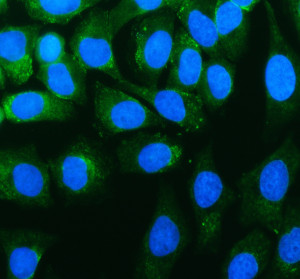 UBE3C Antibody in Human SiHa Cervical Cancer Cells IF. Immunofluorescence staining of human SiHa cervical cancer cells with UBE3C Antibody / Ubiquitin Protein Ligase E3C Antibody at 5 ug/ml. Enzyme-mediated antigen retrieval was performed for 15 min, followed by blocking with 10% goat serum. Cells were incubated with the primary antibody overnight at 4oC. Fluoro488-conjugated goat anti-rabbit IgG was used as the secondary antibody at 1:500 for 30 min at 37oC, and nuclei were counterstained with DAPI (blue). UBE3C staining (green) is observed predominantly in the cytoplasmic region. This UBE3C Antibody enables visualization of Ubiquitin Protein Ligase E3C expression and localization in human cervical cancer cells.