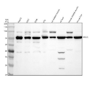 UBE3C Antibody in Human, Rat and Mouse Samples WB. Western blot testing of UBE3C Antibody / Ubiquitin Protein Ligase E3C Antibody using lysates from 1) human HepG2 cells, 2) human U251 glioma cells, 3) human SiHa cervical cancer cells, 4) human RT4 bladder cancer cells, 5) rat small intestine, 6) rat liver, 7) mouse small intestine and 8) mouse liver. The antibody was used at 0.5 ug/ml overnight at 4oC. A prominent band is detected at approximately 70 kDa. The predicted molecular weight of full-length UBE3C is approximately 124 kDa.
