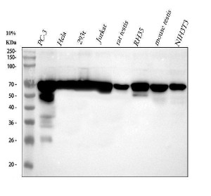 NUP62 Antibody in Human, Rat and Mouse WB. Western blot testing of human, rat and mouse samples with NUP62 Antibody / Nuclear Pore Complex Marker. Lane 1: PC-3; Lane 2: HeLa; Lane 3: 293T; Lane 4: Jurkat; Lane 5: rat testis; Lane 6: rat RH35; Lane 7: mouse testis; Lane 8: mouse NIH/3T3. Samples were separated by 5-20% SDS-PAGE under reducing conditions and the antibody was used at 1:500 overnight at 4oC. A prominent NUP62 band was observed at approximately 70 kDa across the tested samples, demonstrating detection in human, rat and mouse cells and tissues.