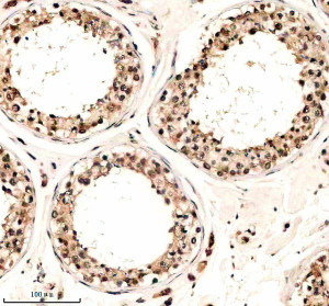 Phospho-Cyclin E1 (T77) Antibody in Human Testis IHC. Immunohistochemistry staining of FFPE human testis tissue with Phospho-Cyclin E1 (T77) Antibody / Phospho-CCNE1 Antibody. HIER was performed in EDTA buffer, pH 8.0, followed by blocking with 10% goat serum. The antibody was used at 1:50 overnight at 4oC, followed by a peroxidase-conjugated goat anti-rabbit IgG secondary antibody and DAB detection. This Phospho-Cyclin E1 Antibody demonstrates staining in human testis tissue.