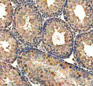 Phospho-Cyclin E1 (T77) Antibody in Mouse Testis IHC. Immunohistochemistry staining of FFPE mouse testis tissue with Phospho-Cyclin E1 (T77) Antibody / Phospho-CCNE1 Antibody. HIER was performed in EDTA buffer, pH 8.0, followed by blocking with 10% goat serum. The antibody was used at 1:50 overnight at 4oC, followed by a peroxidase-conjugated goat anti-rabbit IgG secondary antibody and DAB detection. This Phospho-CCNE1 Antibody demonstrates tissue staining in mouse testis.