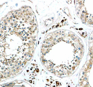 CYP17A1 Antibody in Human Testis IHC. Immunohistochemistry staining of FFPE human testis tissue with CYP17A1 Antibody / Steroid 17-Alpha-Hydroxylase Antibody. HIER was performed in EDTA buffer, pH 8.0, followed by blocking with 10% goat serum. The antibody was used at 1:50 overnight at 4oC, followed by a peroxidase-conjugated goat anti-rabbit IgG secondary antibody and DAB detection. This CYP17A1 Antibody demonstrates steroid 17-alpha-hydroxylase localization in human testis tissue.