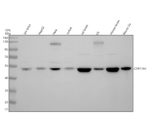 CYP17A1 Antibody in Human, Rat and Mouse WB. Western blot testing of human, rat and mouse samples with CYP17A1 Antibody / Steroid 17-Alpha-Hydroxylase Antibody. Lane 1: human SH-SY5Y; Lane 2: human HepG2; Lane 3: human HeLa; Lane 4: human Jurkat; Lane 5: rat brain; Lane 6: rat C6; Lane 7: mouse brain; Lane 8: mouse Neuro-2a. Samples were separated by SDS-PAGE under reducing conditions and the antibody was used at 1:500 overnight at 4oC. A prominent CYP17A1 band was observed at approximately 52 kDa across the tested samples, demonstrating detection of steroid 17-alpha-hydroxylase in human, rat and mouse samples.