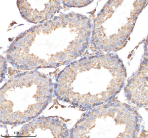CYP17A1 Antibody in Mouse Testis IHC. Immunohistochemistry staining of FFPE mouse testis tissue with CYP17A1 Antibody / Steroid 17-Alpha-Hydroxylase Antibody. HIER was performed in EDTA buffer, pH 8.0, followed by blocking with 10% goat serum. The antibody was used at 1:50 overnight at 4oC, followed by a peroxidase-conjugated goat anti-rabbit IgG secondary antibody and DAB detection. This CYP17A1 Antibody demonstrates steroidogenic enzyme localization in mouse testis tissue.